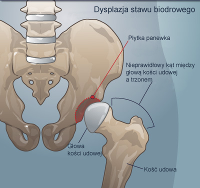 dzieci które robią kupę do pieluchy