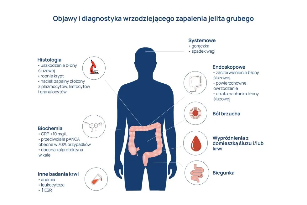 pieluchomajtki limit nfz obliczanie